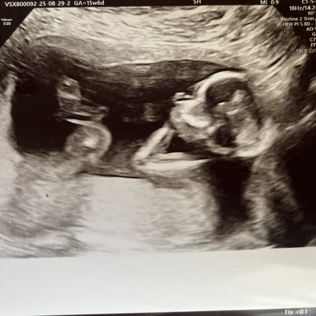 Photo shared by Gracie for their Babylist baby registry.