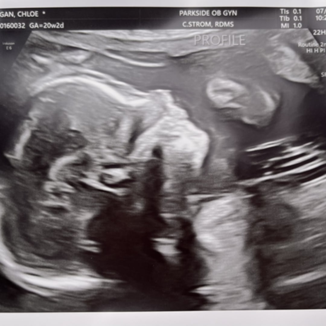 Photo shared by Chloe for their Babylist baby registry.