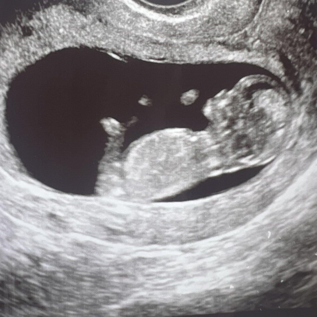 Photo shared by Erin for their Babylist baby registry.