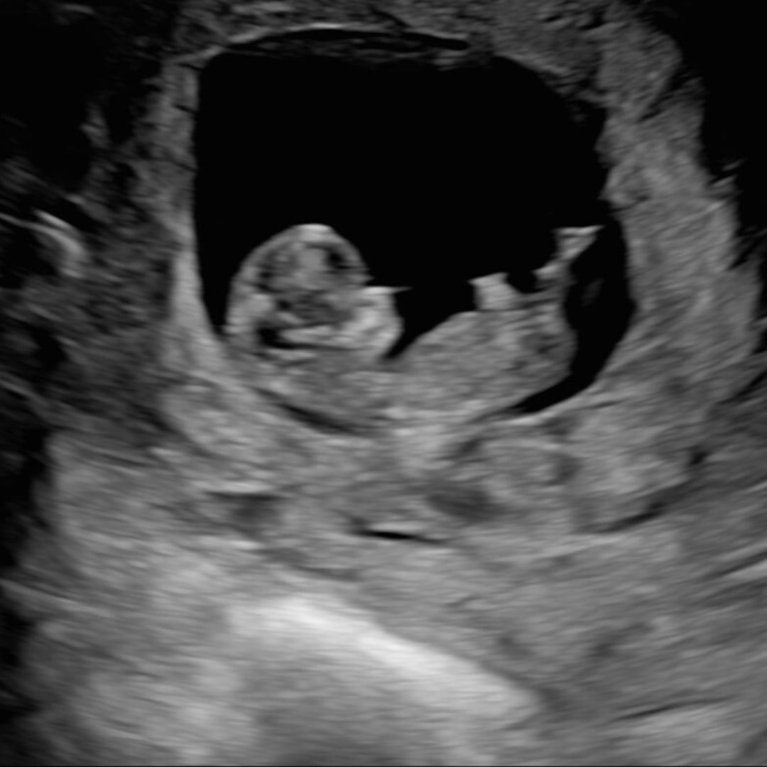 Photo shared by Brooke for their Babylist baby registry.