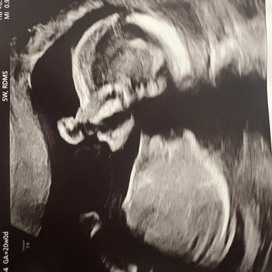 Photo shared by Madison for their Babylist baby registry.