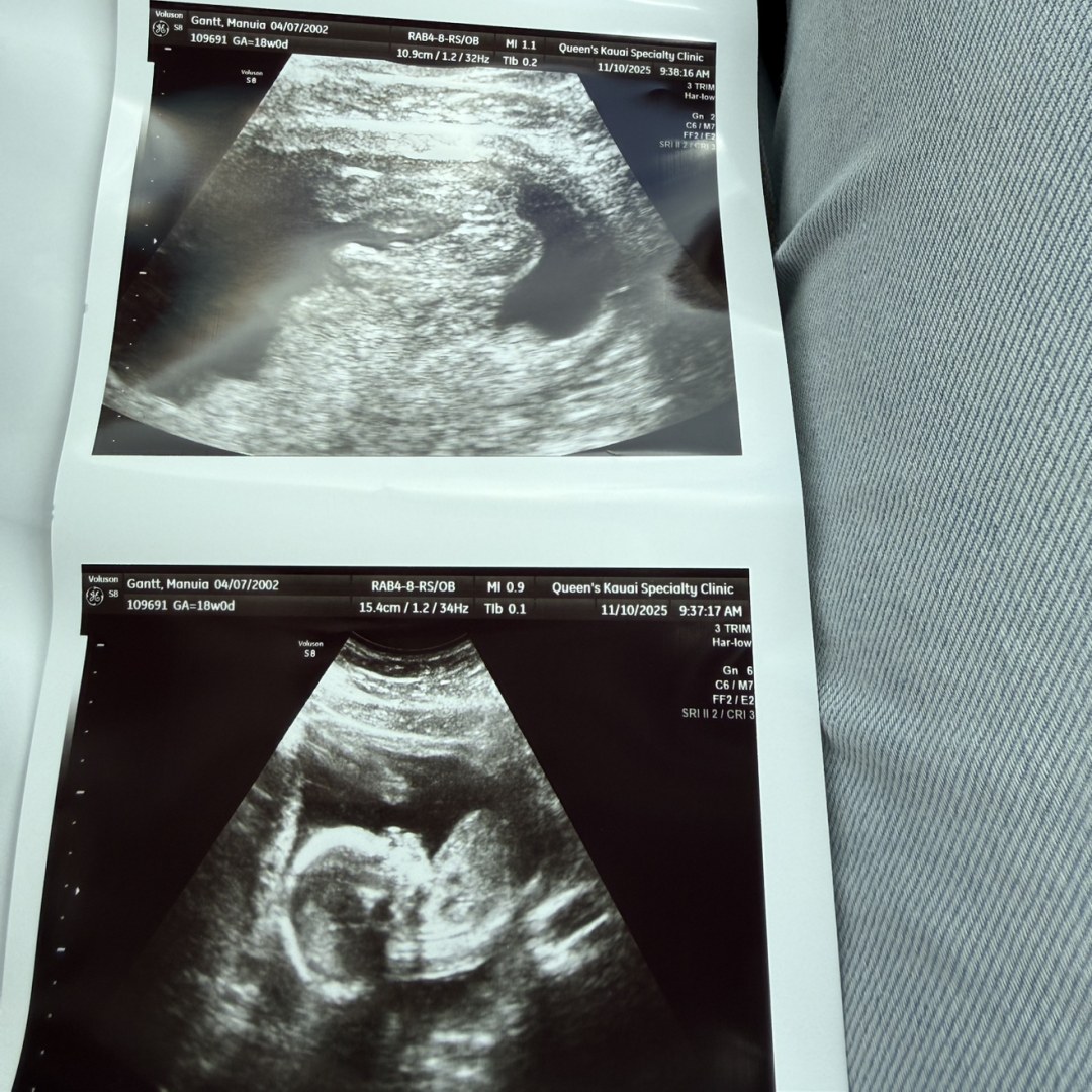 Photo shared by Manuia for their Babylist baby registry.