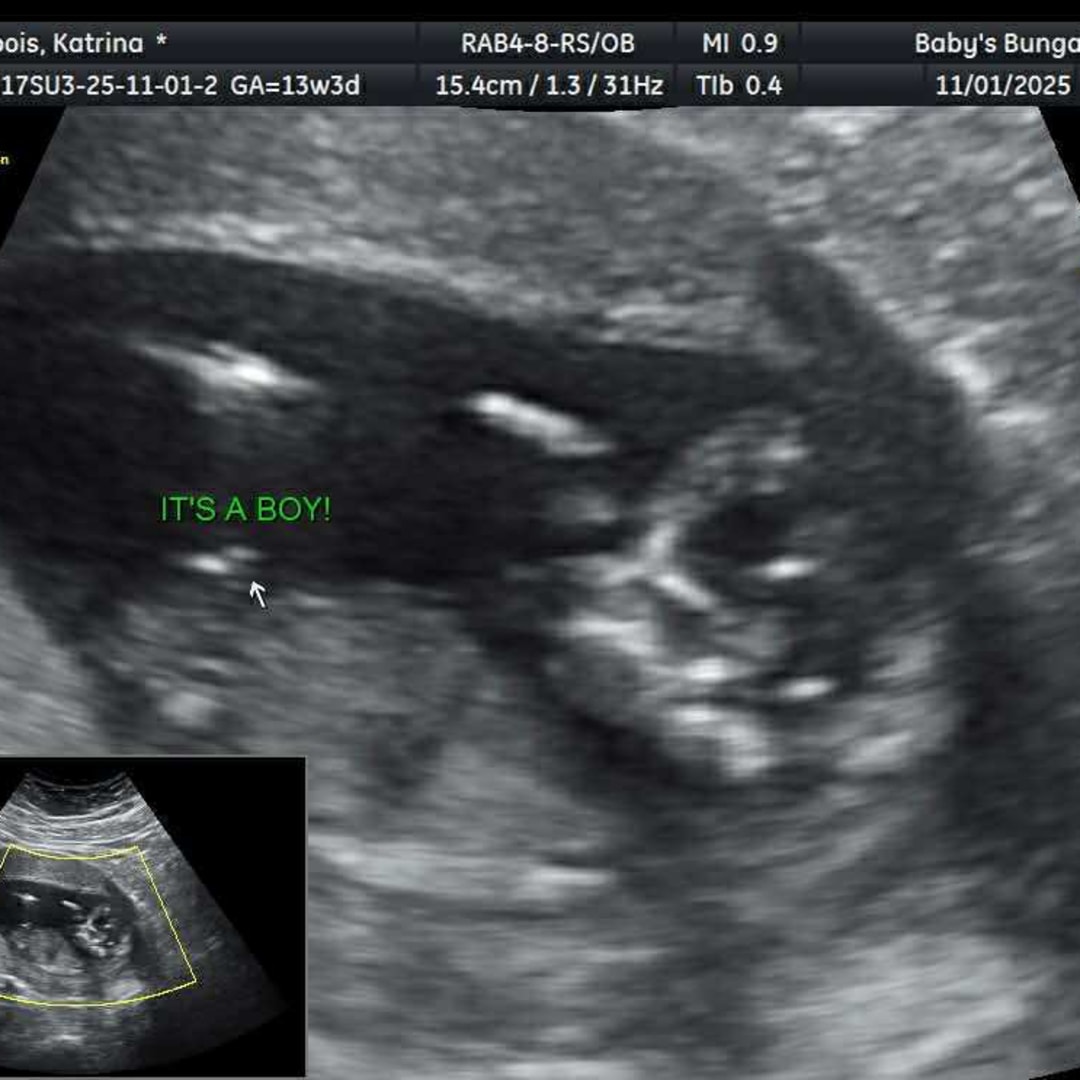 Photo shared by Katrina for their Babylist baby registry.