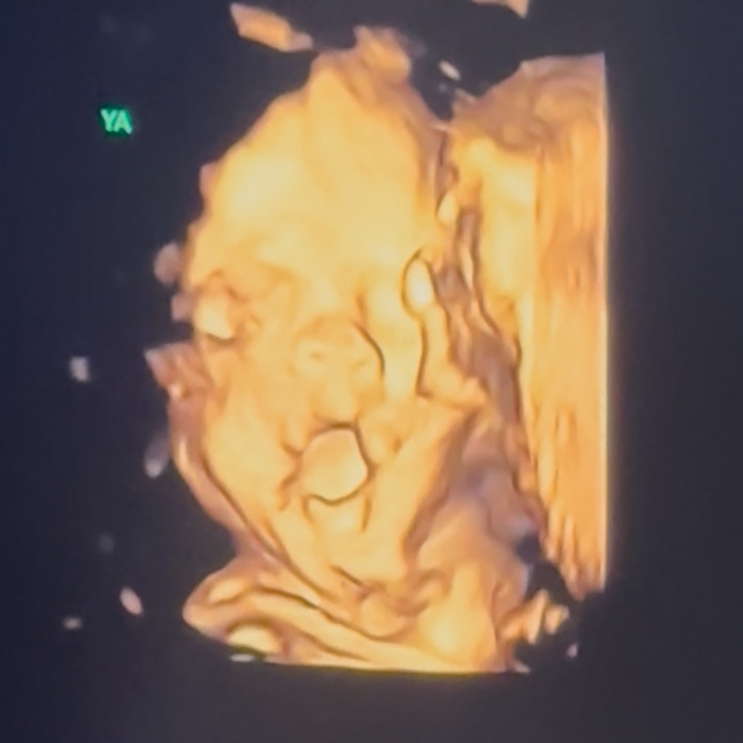 Photo shared by Josie for their Babylist baby registry.