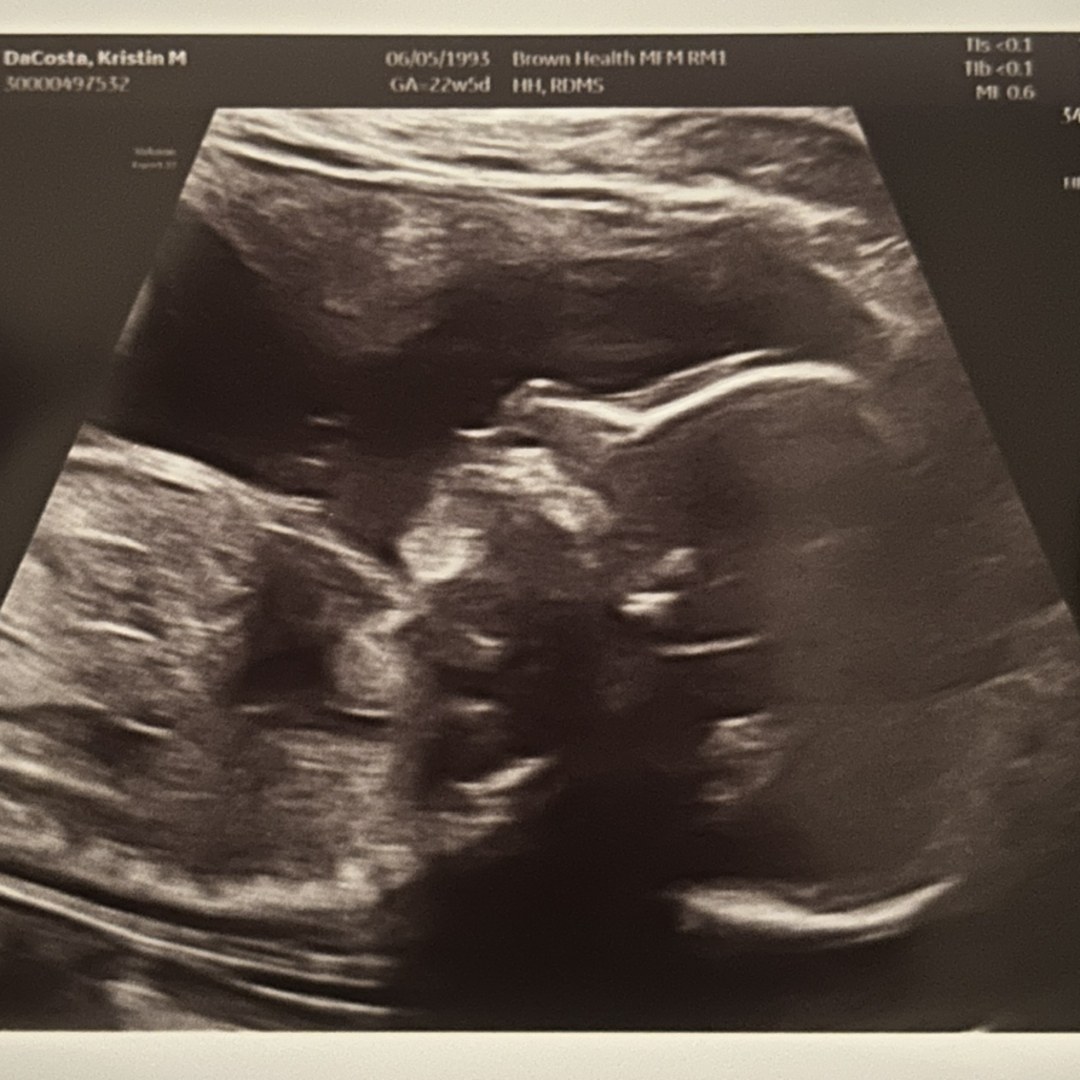 Photo shared by Kristin for their Babylist baby registry.