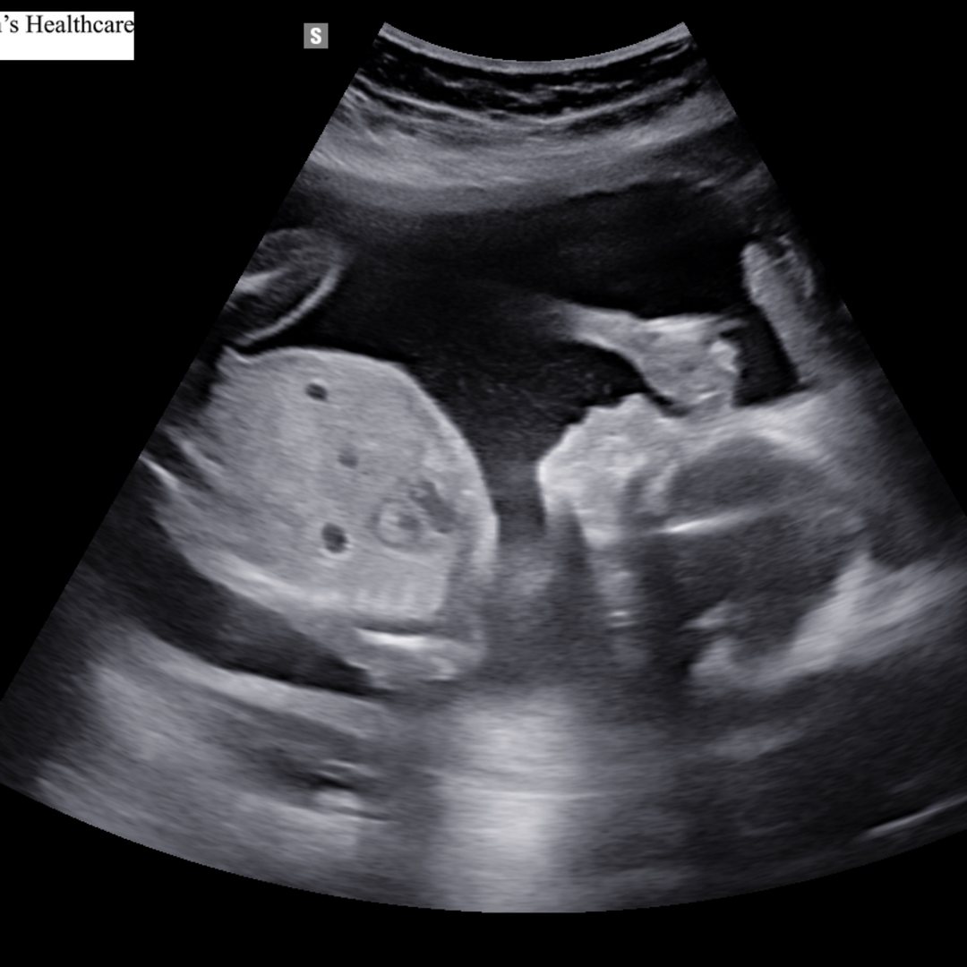 Photo shared by Haylee for their Babylist baby registry.