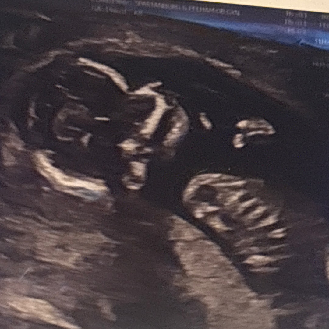 Photo shared by Crystal for their Babylist baby registry.