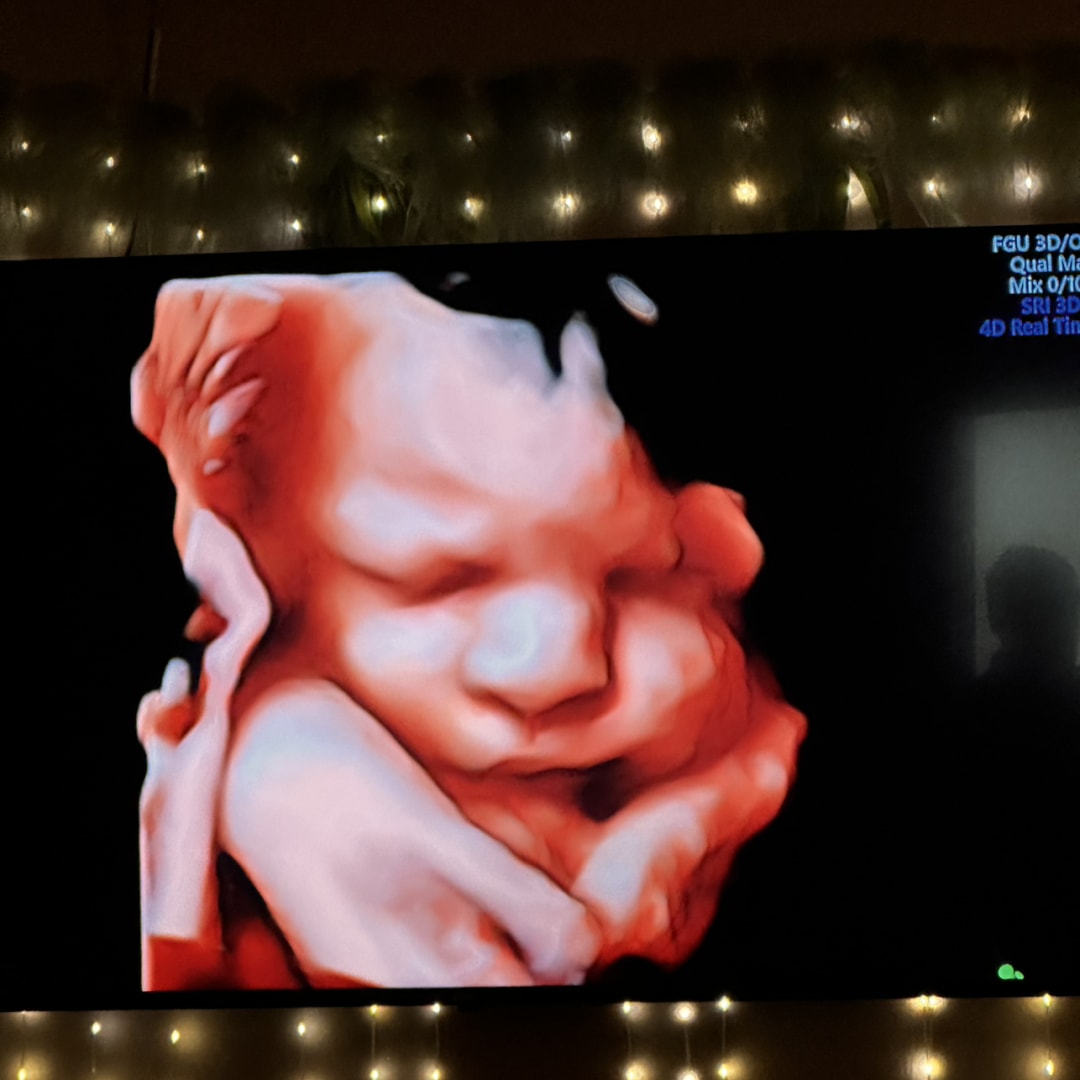 Photo shared by Lareesa for their Babylist baby registry.