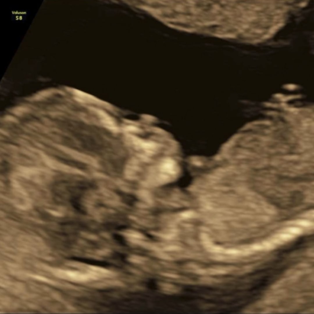 Photo shared by Sally for their Babylist baby registry.