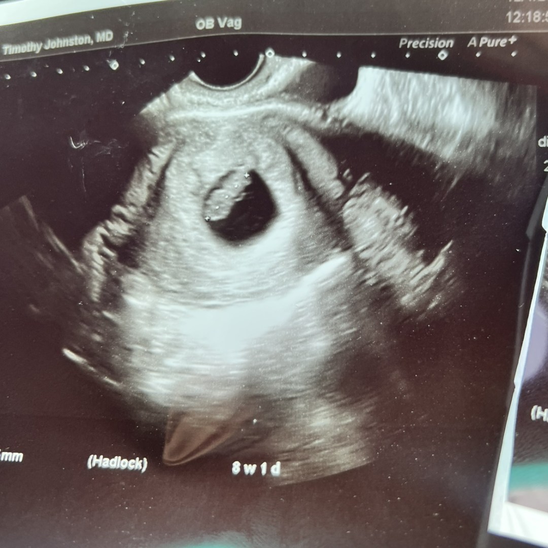 Photo shared by Jacqueline for their Babylist baby registry.