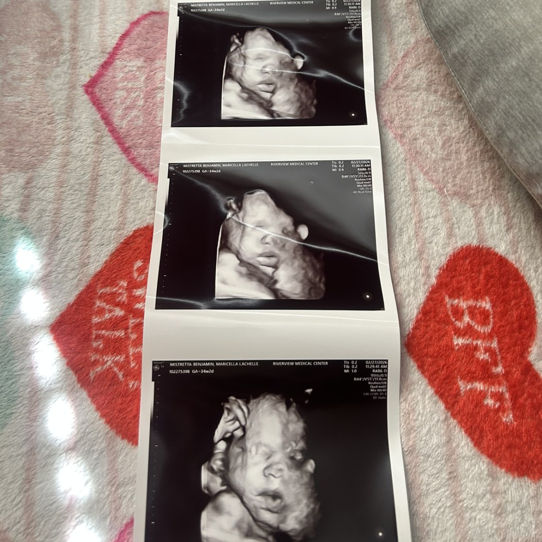 Photo shared by Chella for their Babylist baby registry.