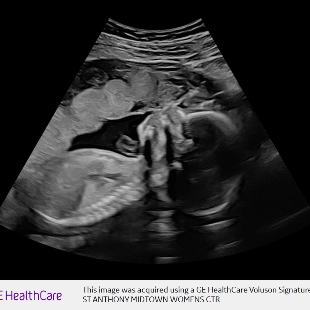 Photo shared by Deserae for their Babylist baby registry.