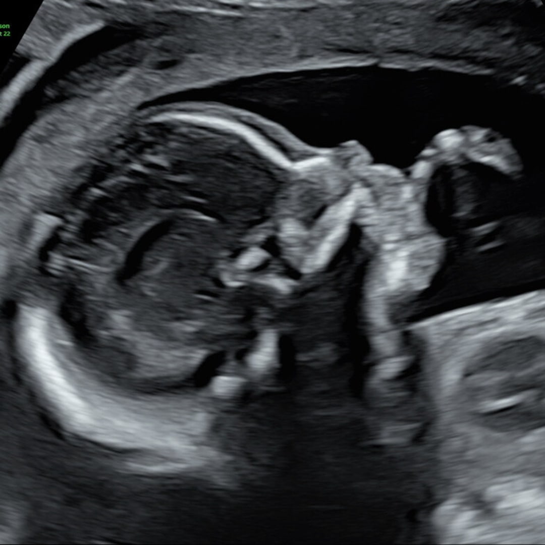 Photo shared by Bernie and Lucy for their Babylist baby registry.