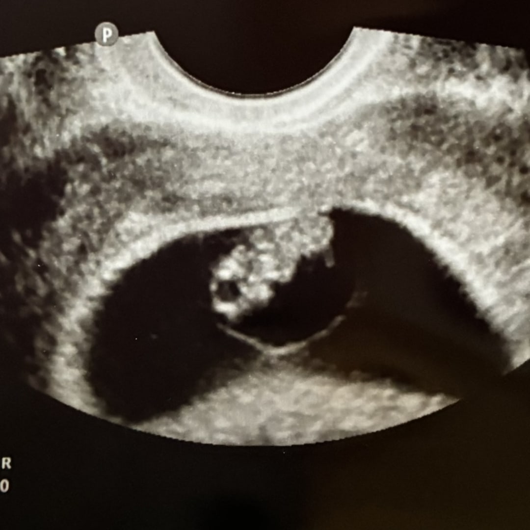 Photo shared by Erin for their Babylist baby registry.
