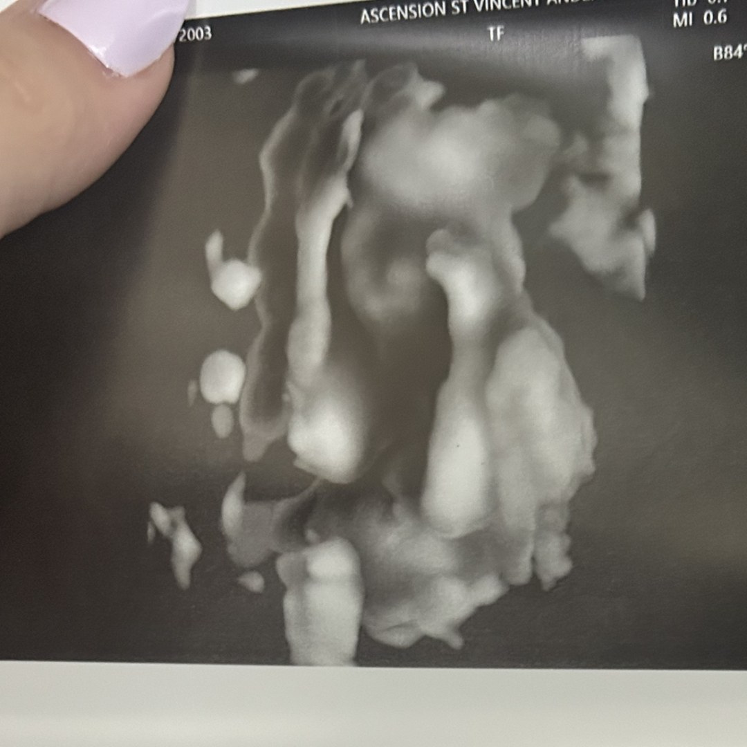 Photo shared by Taylor for their Babylist baby registry.