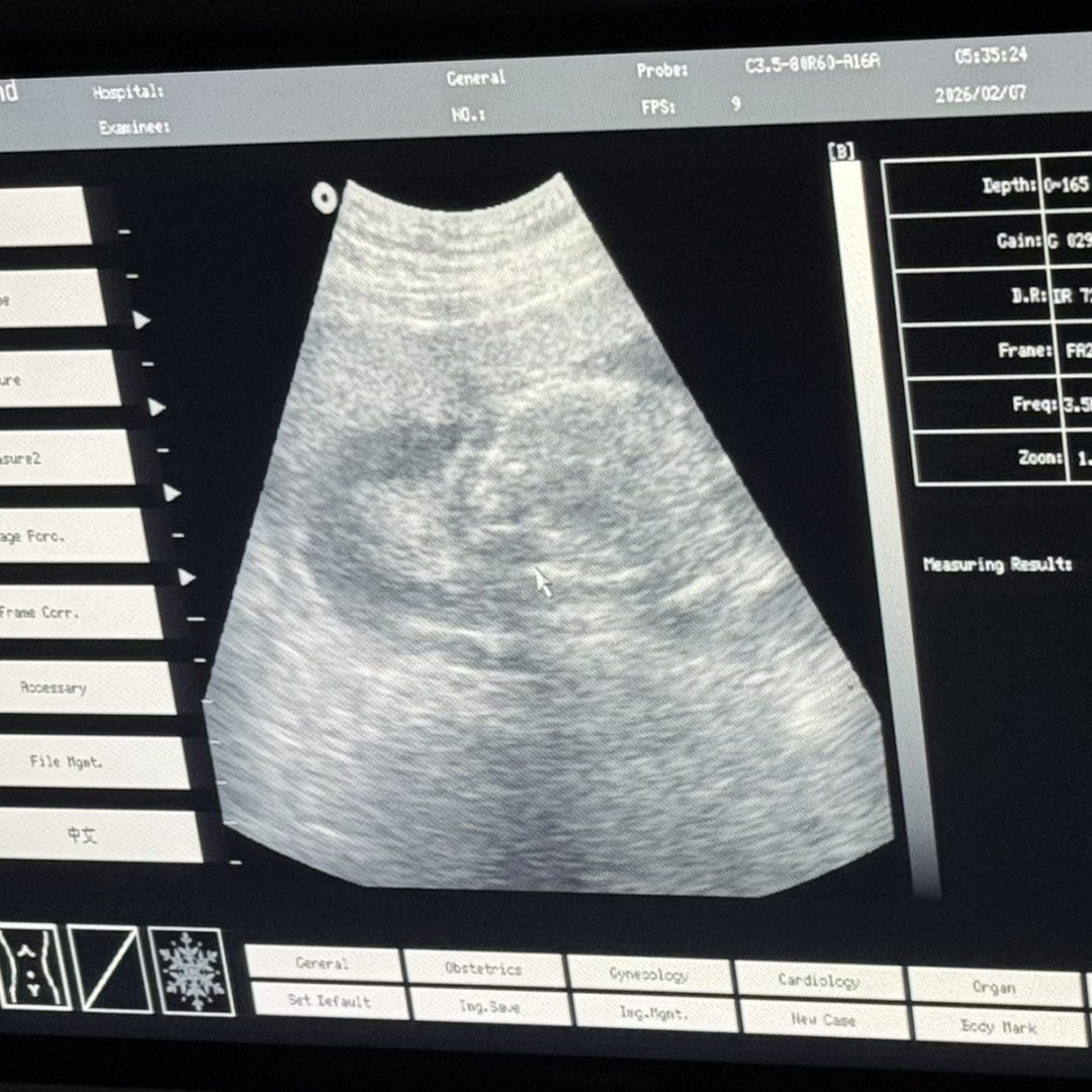 Photo shared by Cassidy for their Babylist baby registry.