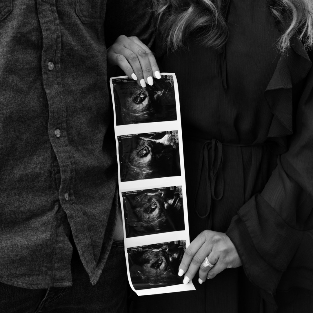 Photo shared by Hannah for their Babylist baby registry.