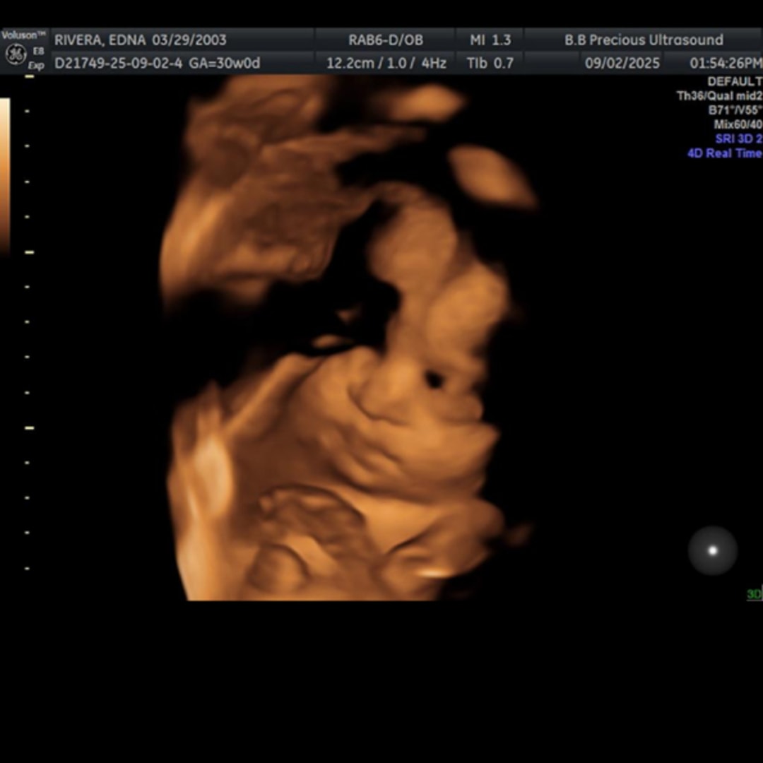 Photo shared by Edna for their Babylist baby registry.