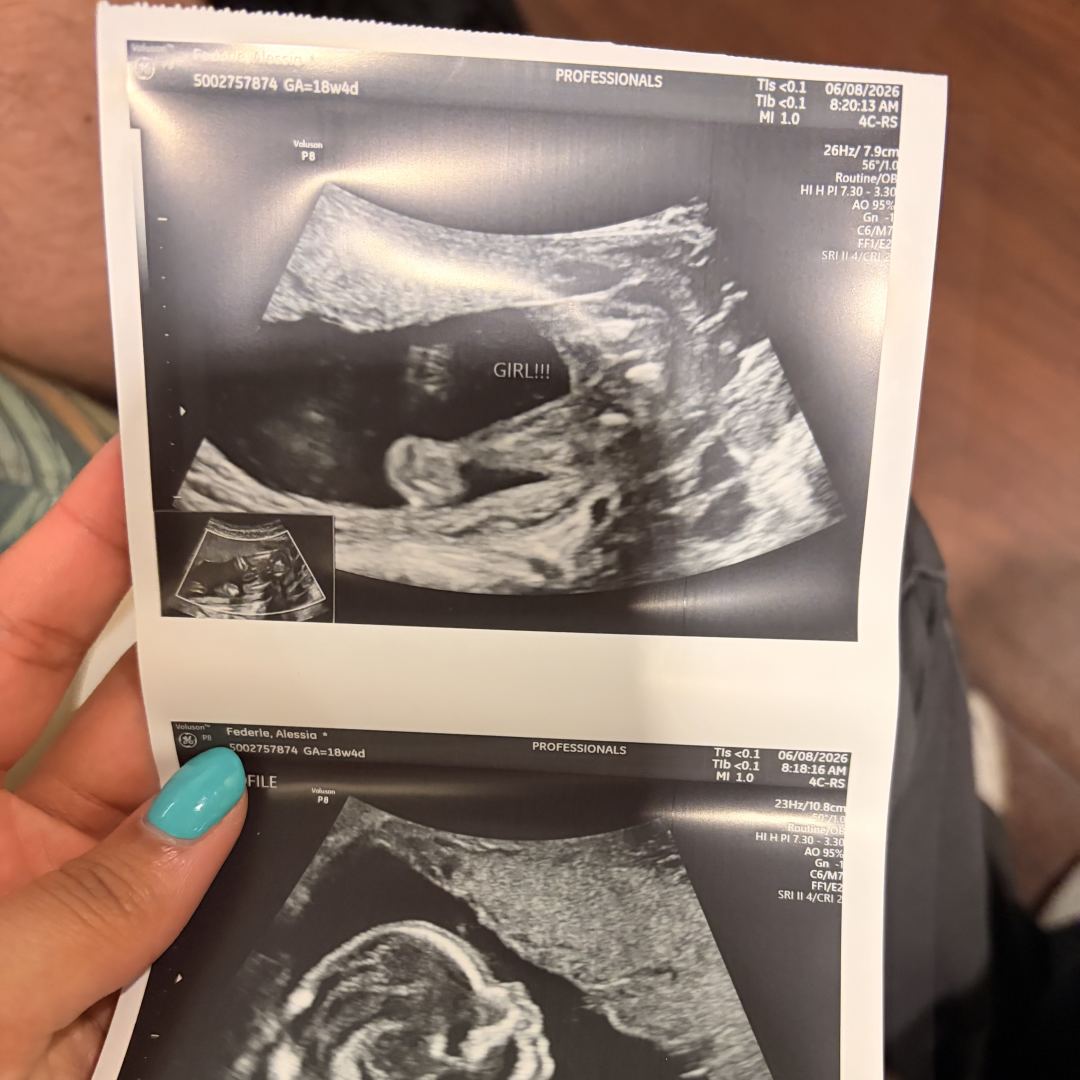 Photo shared by Alessia for their Babylist baby registry.