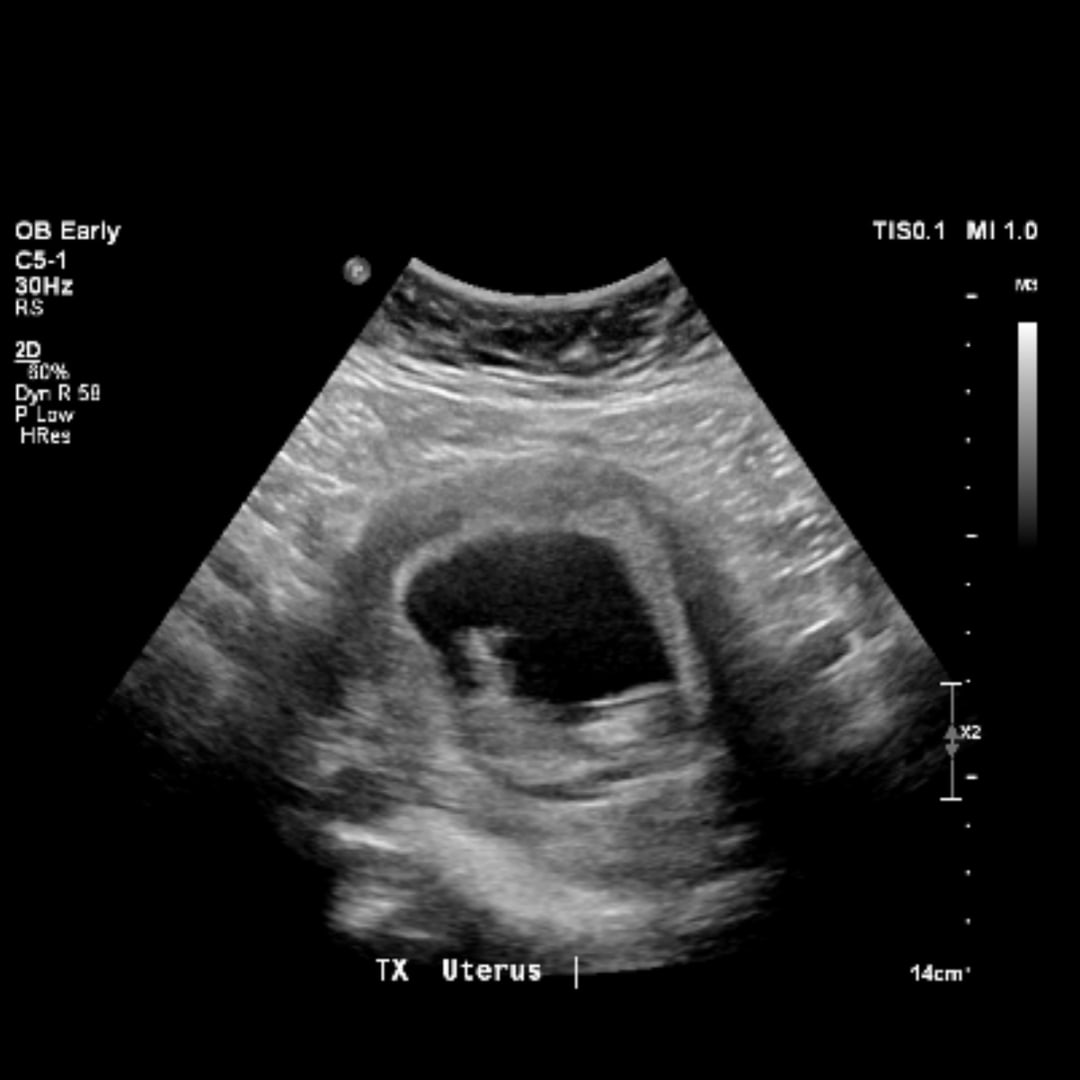 Photo shared by Tessa for their Babylist baby registry.