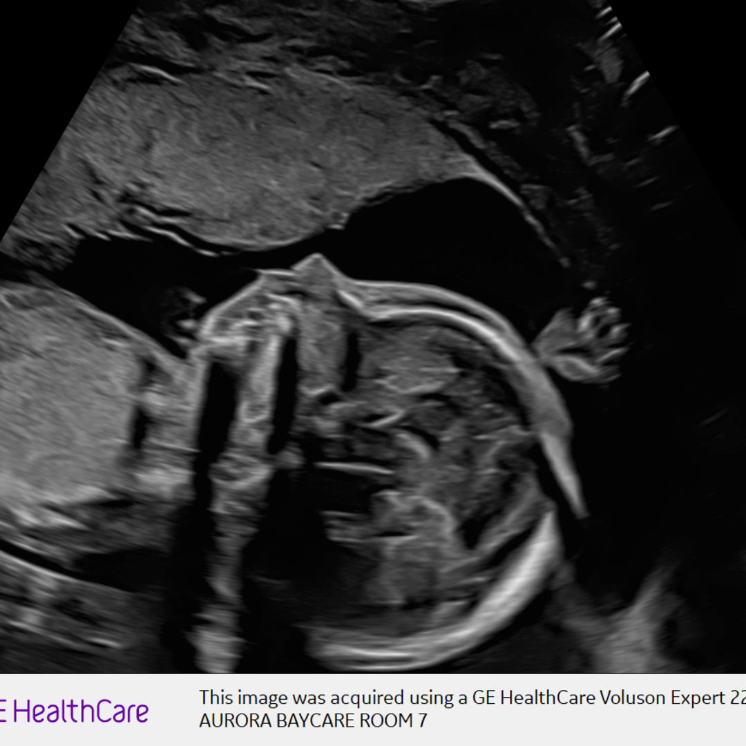 Photo shared by Olivia for their Babylist baby registry.