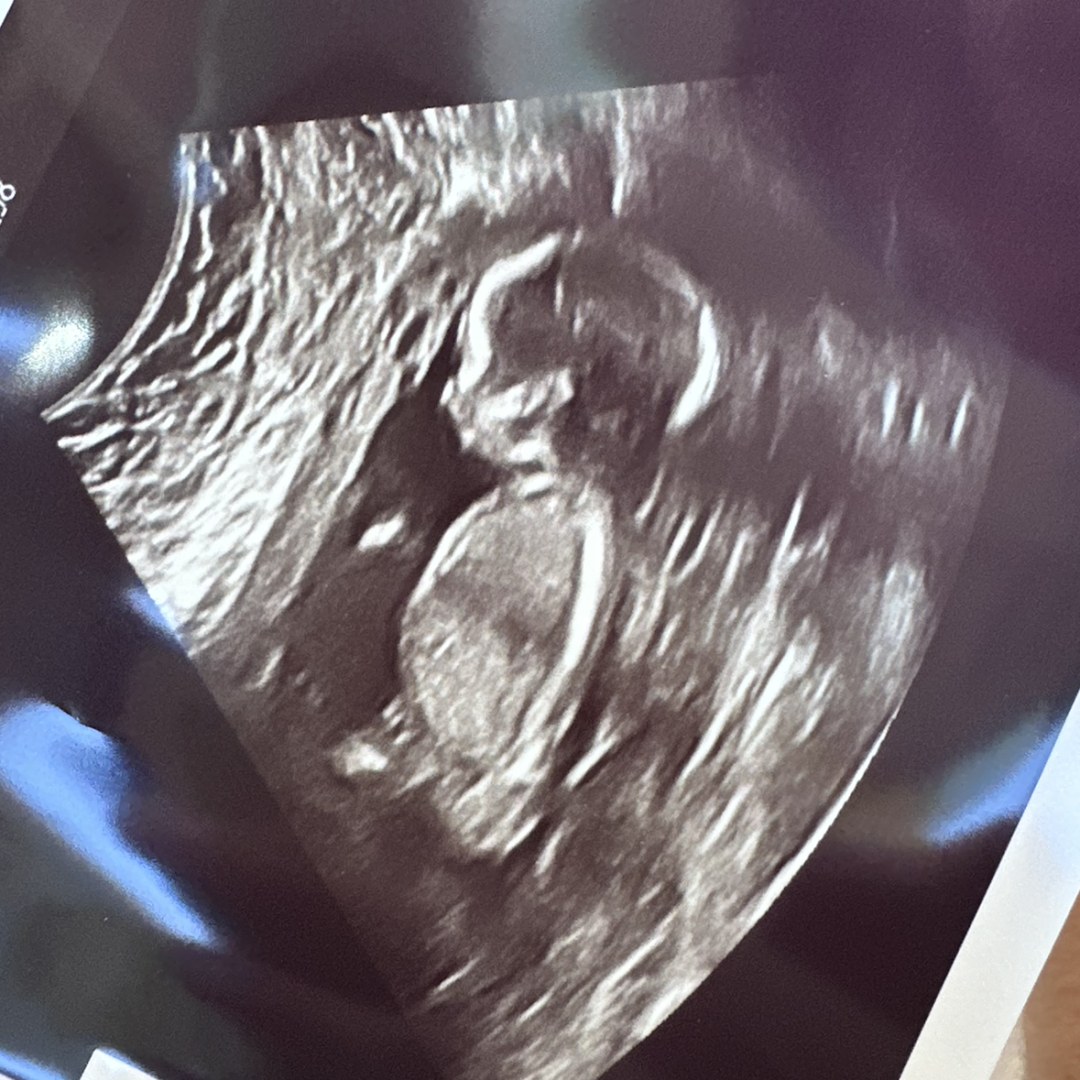 Photo shared by Anyssa for their Babylist baby registry.