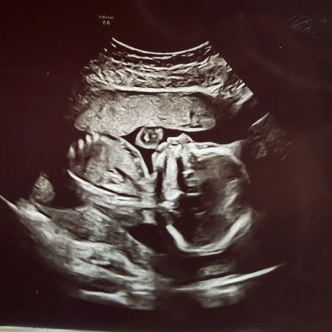 Photo shared by Alexandra for their Babylist baby registry.