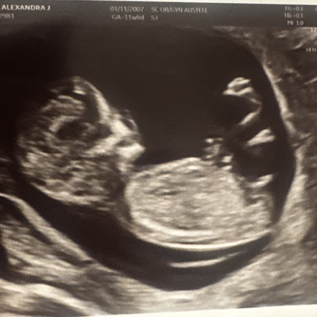 Photo shared by Alexandra for their Babylist baby registry.