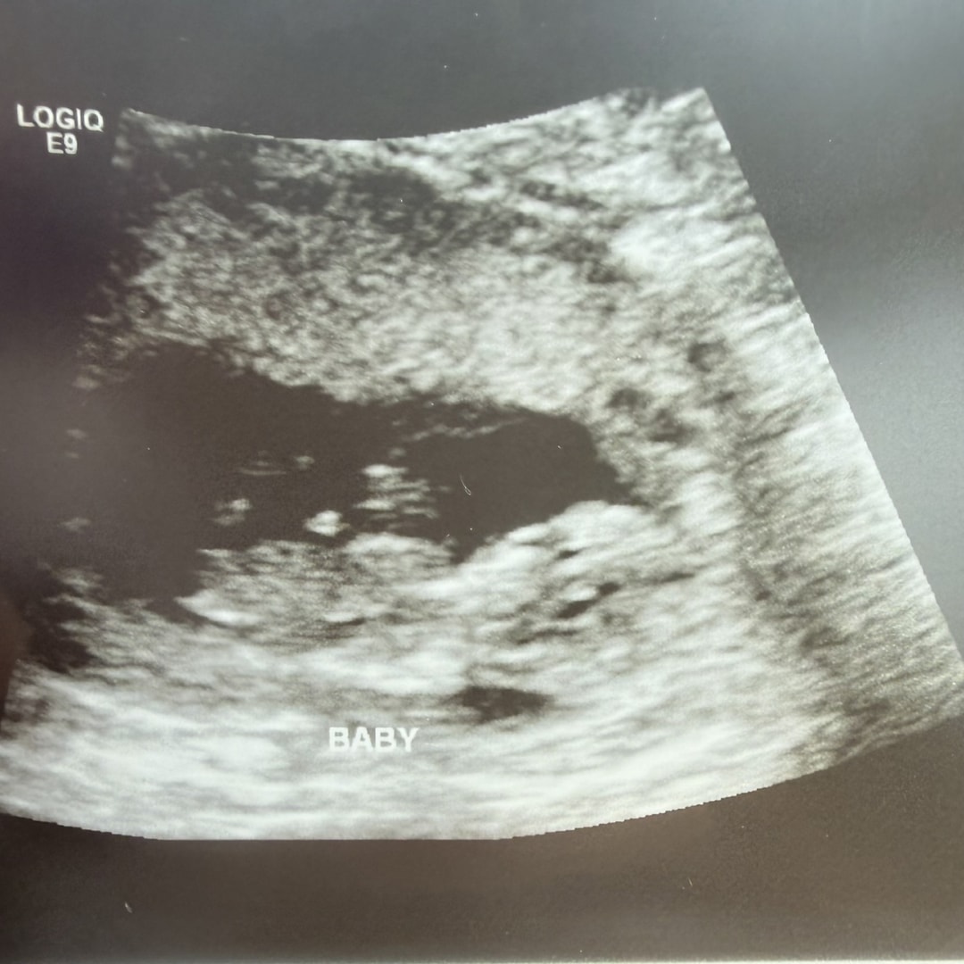 Photo shared by Lauren for their Babylist baby registry.