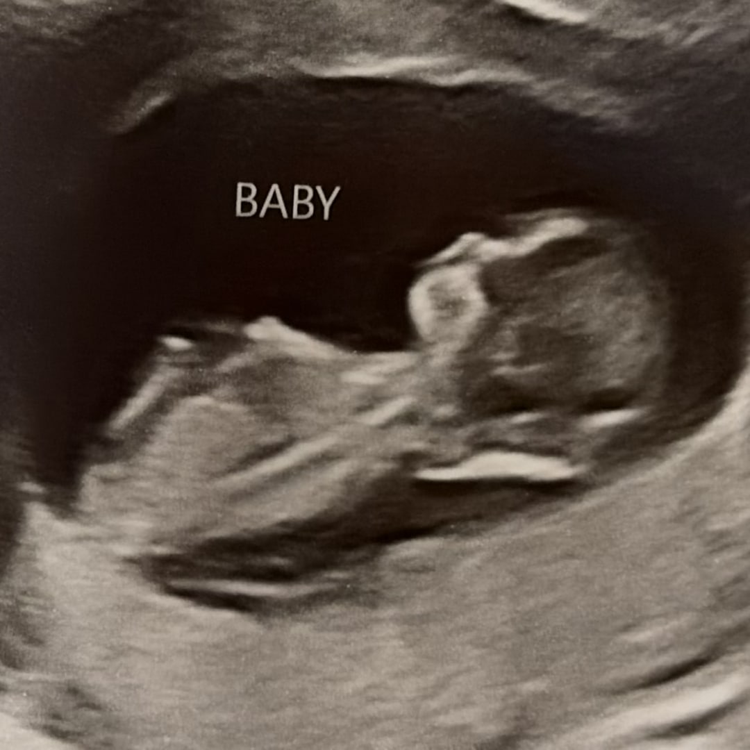 Photo shared by Natalie for their Babylist baby registry.