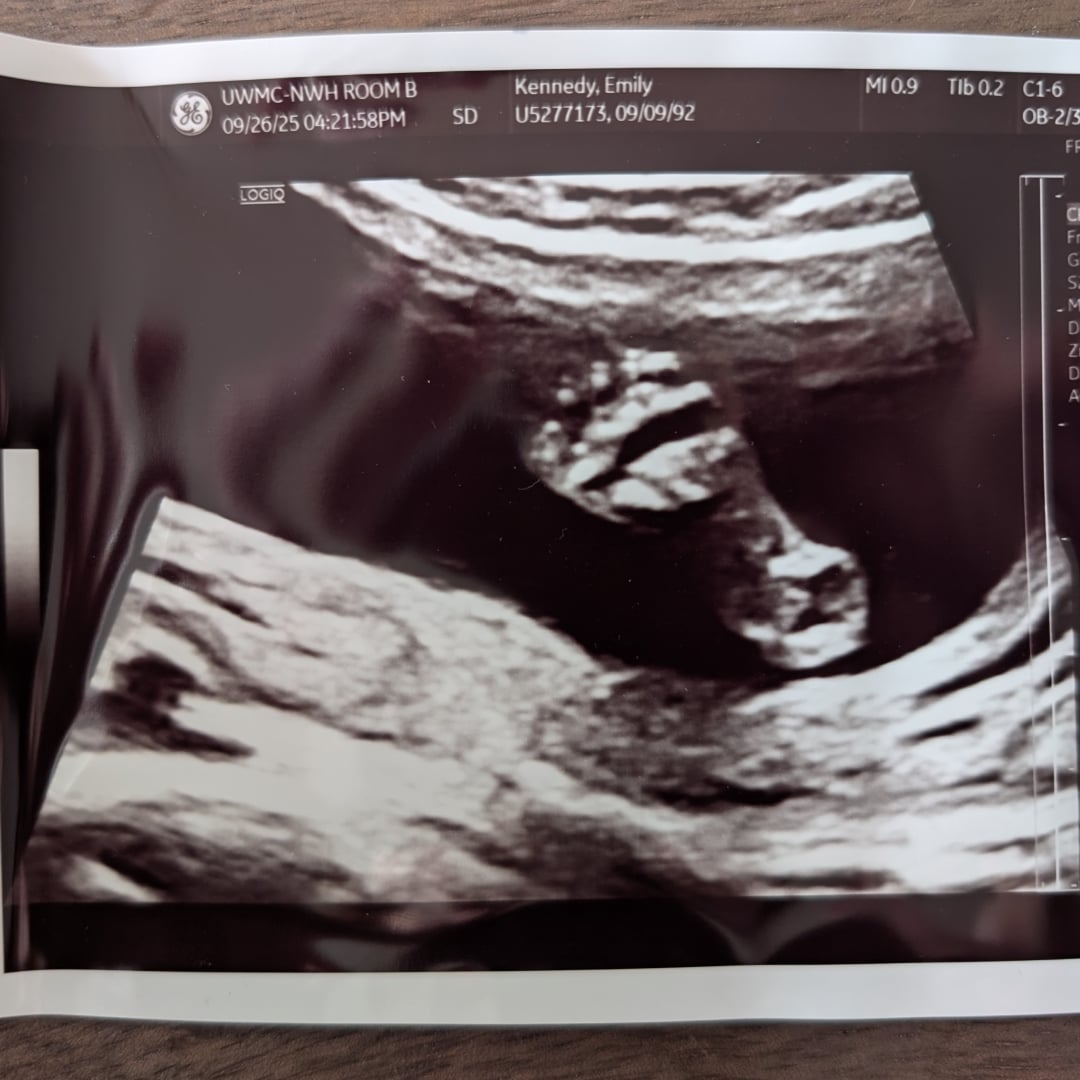 Photo shared by Emily for their Babylist baby registry.