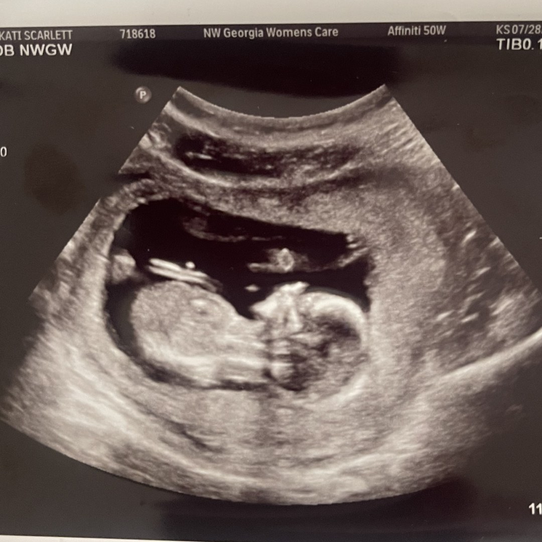 Photo shared by Kati for their Babylist baby registry.