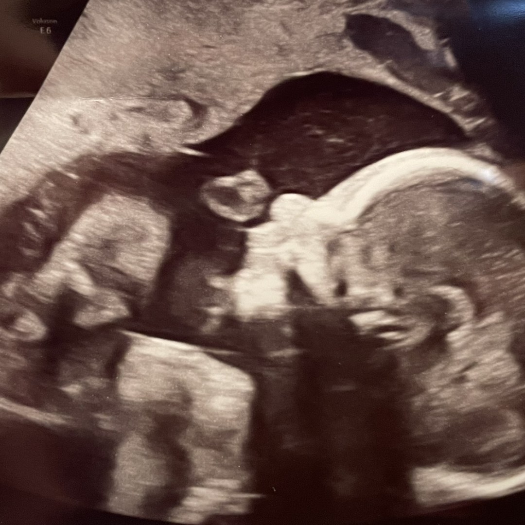 Photo shared by Rachael for their Babylist baby registry.