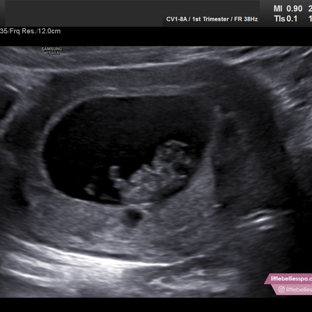 Photo shared by Courtney for their Babylist baby registry.