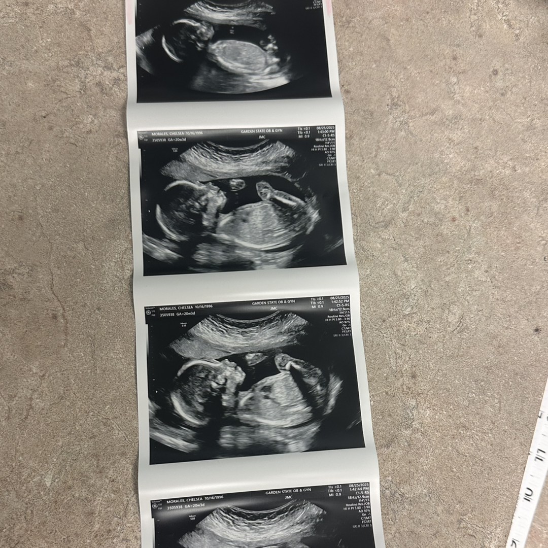 Photo shared by Chelsea for their Babylist baby registry.