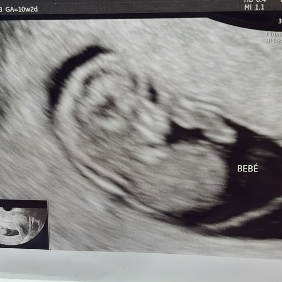 Photo shared by Lenny for their Babylist baby registry.