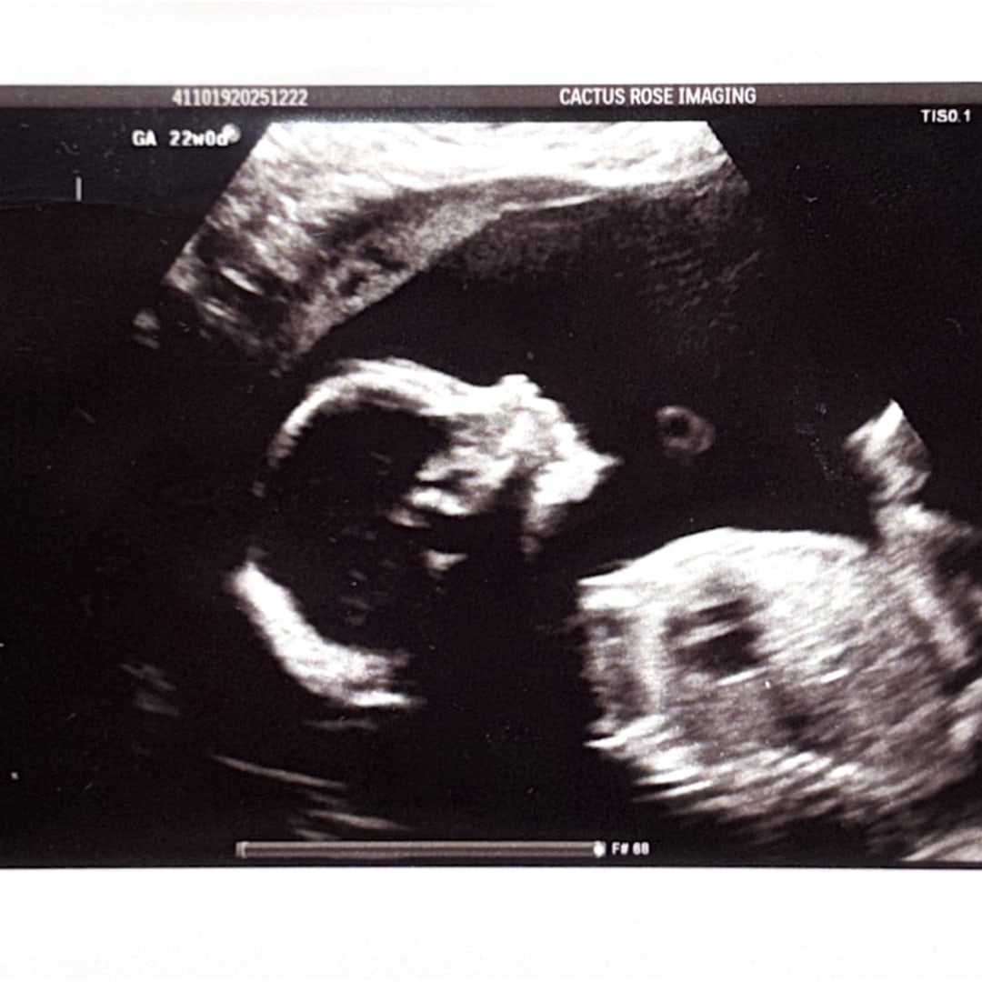 Photo shared by Audra for their Babylist baby registry.