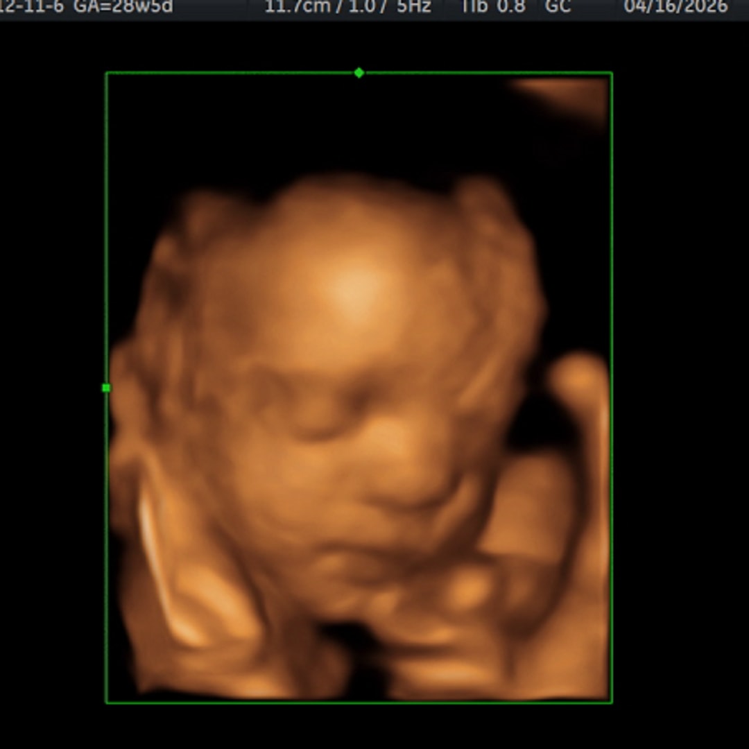 Photo shared by Erica for their Babylist baby registry.