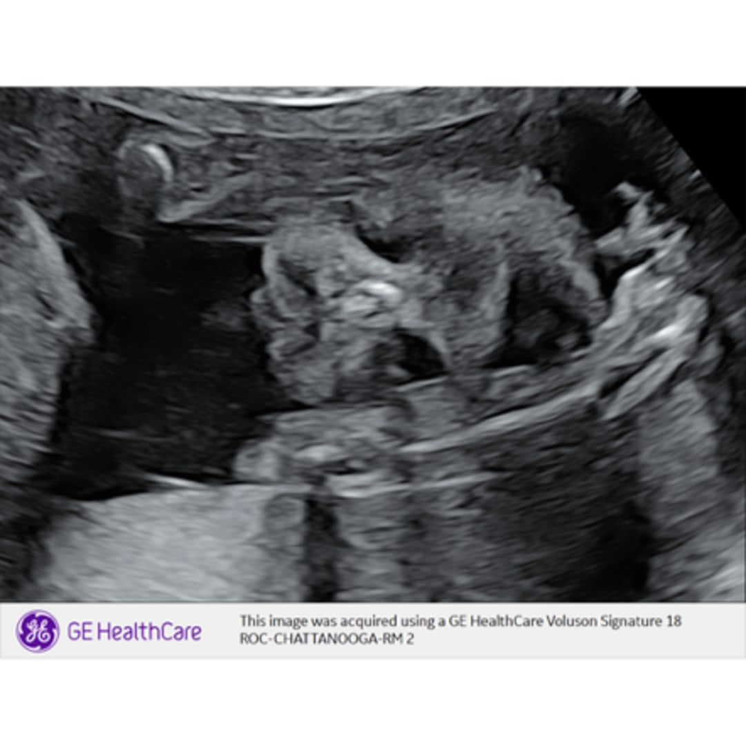 Photo shared by Emily for their Babylist baby registry.