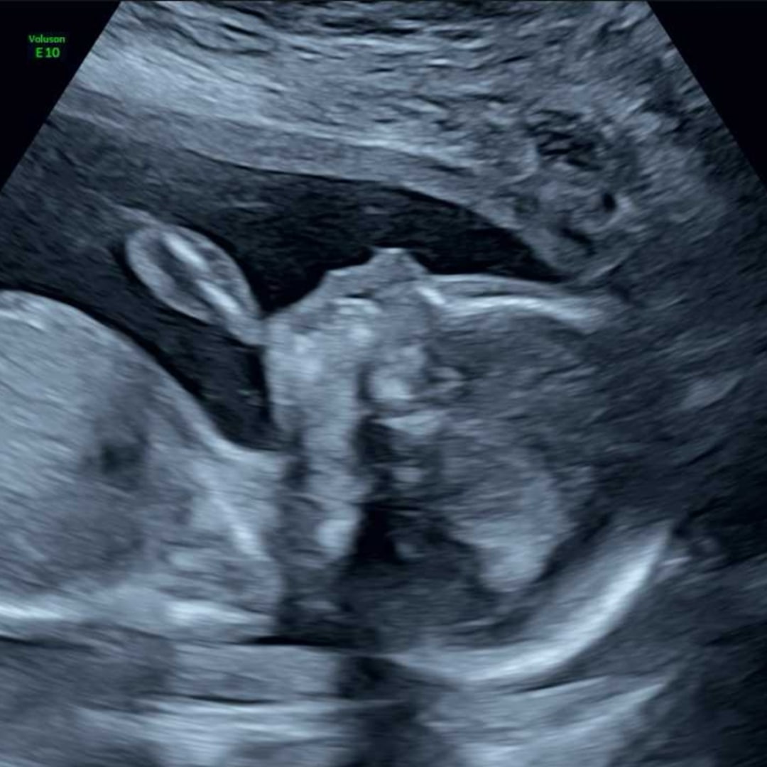 Photo shared by Jessica for their Babylist baby registry.