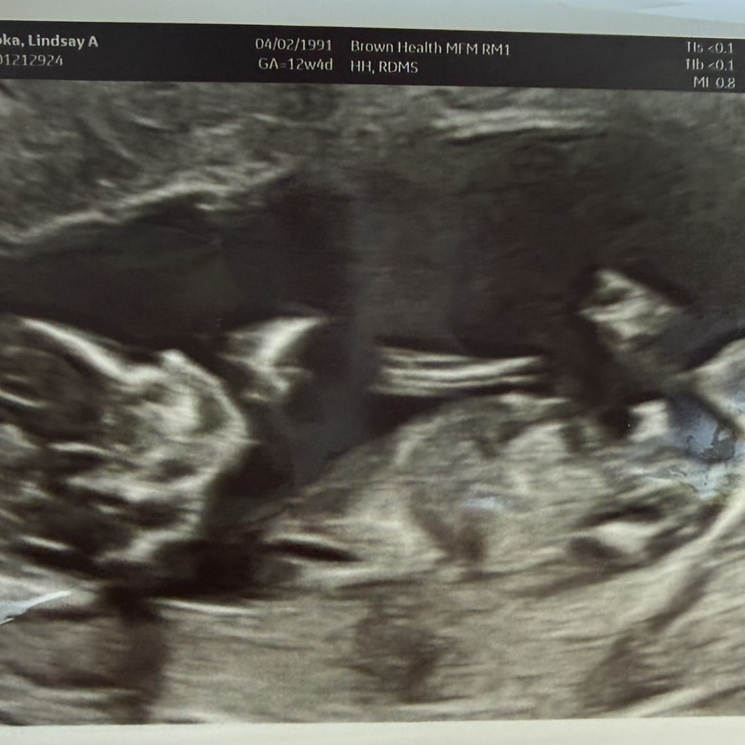 Photo shared by Lindsay for their Babylist baby registry.
