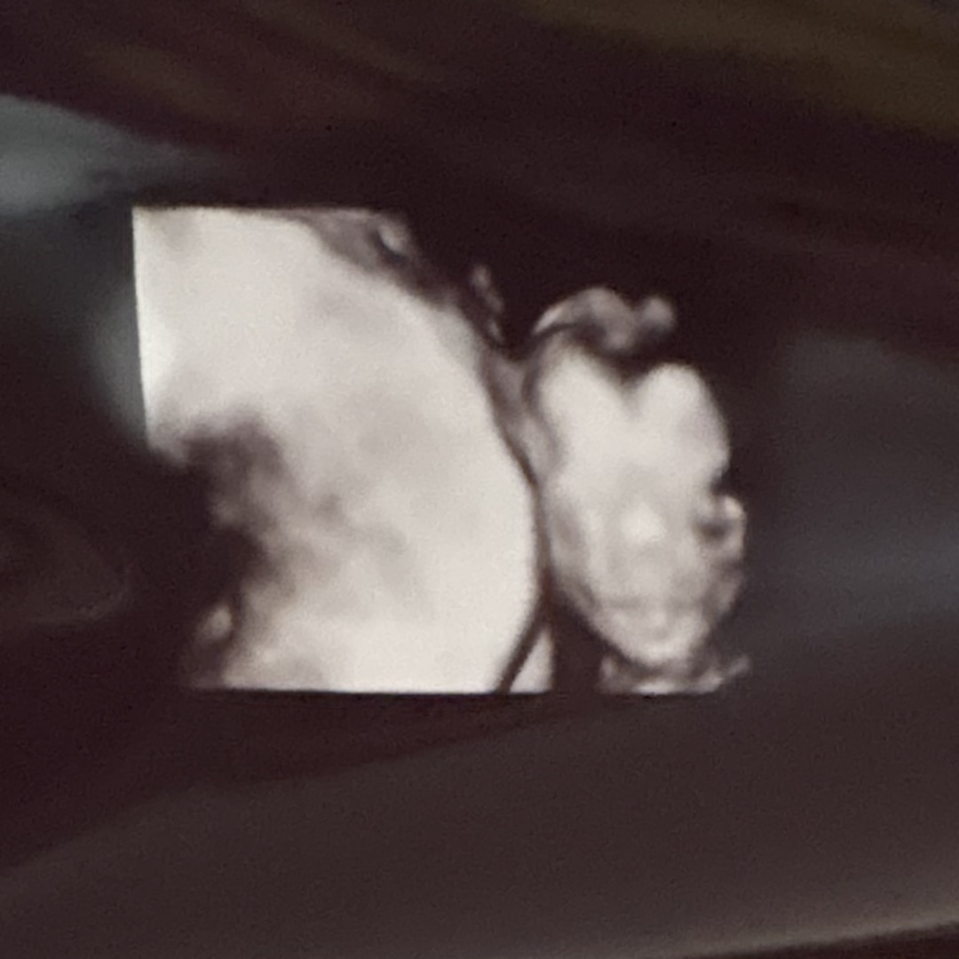Photo shared by Emilie for their Babylist baby registry.