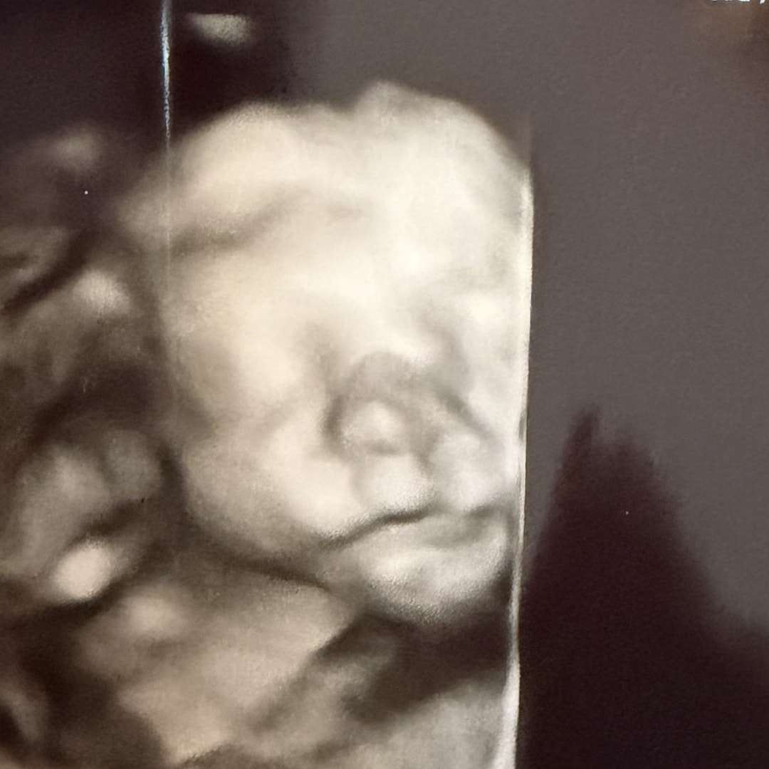 Photo shared by Kennadi for their Babylist baby registry.