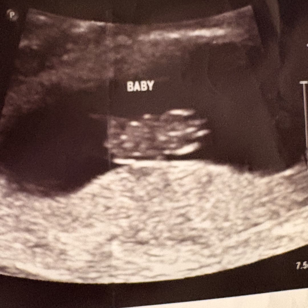 Photo shared by Brooklyn for their Babylist baby registry.