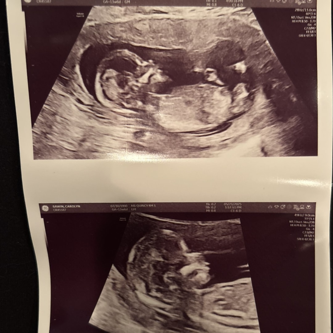 Photo shared by Carolyn for their Babylist baby registry.