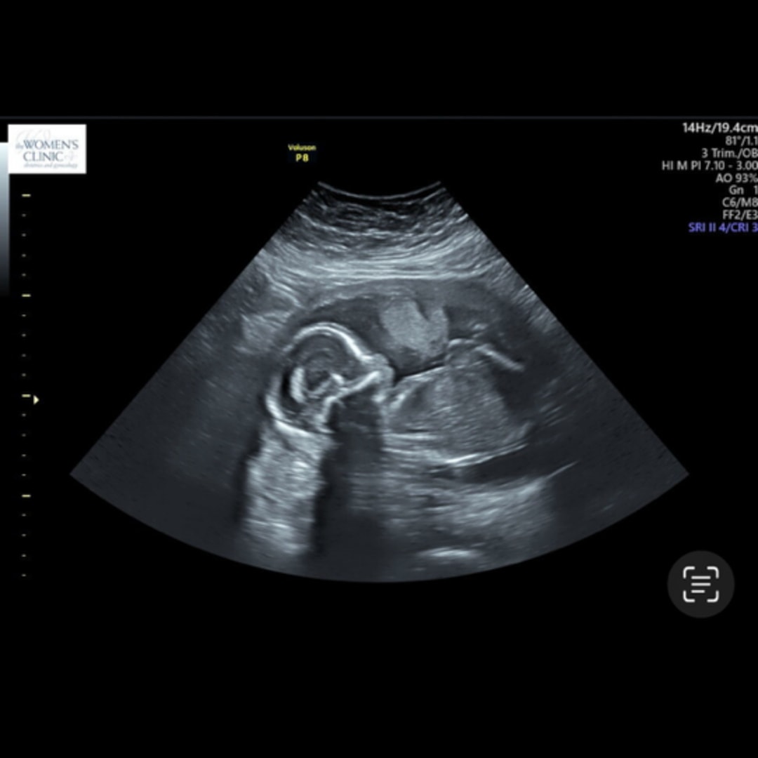 Photo shared by Aryn for their Babylist baby registry.