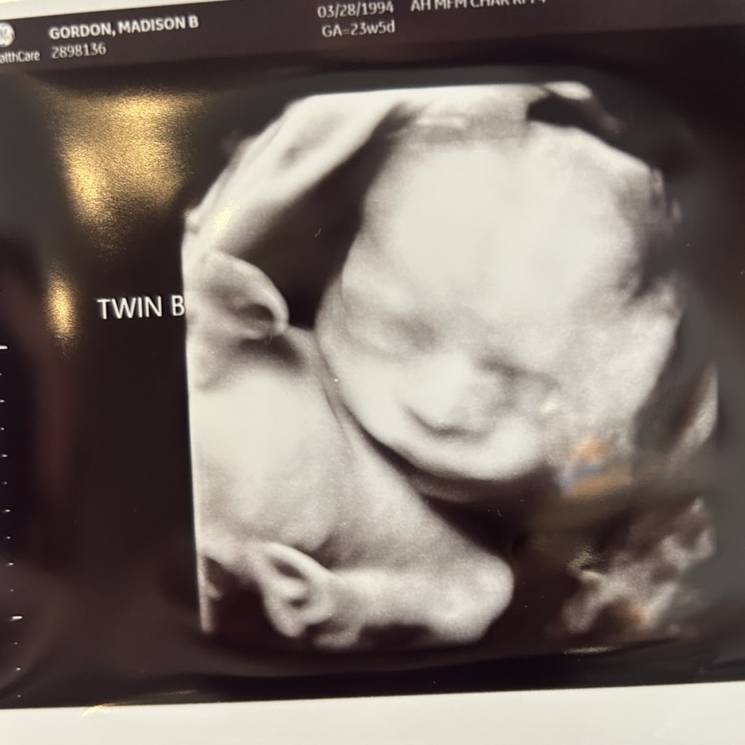 Photo shared by Madison for their Babylist baby registry.