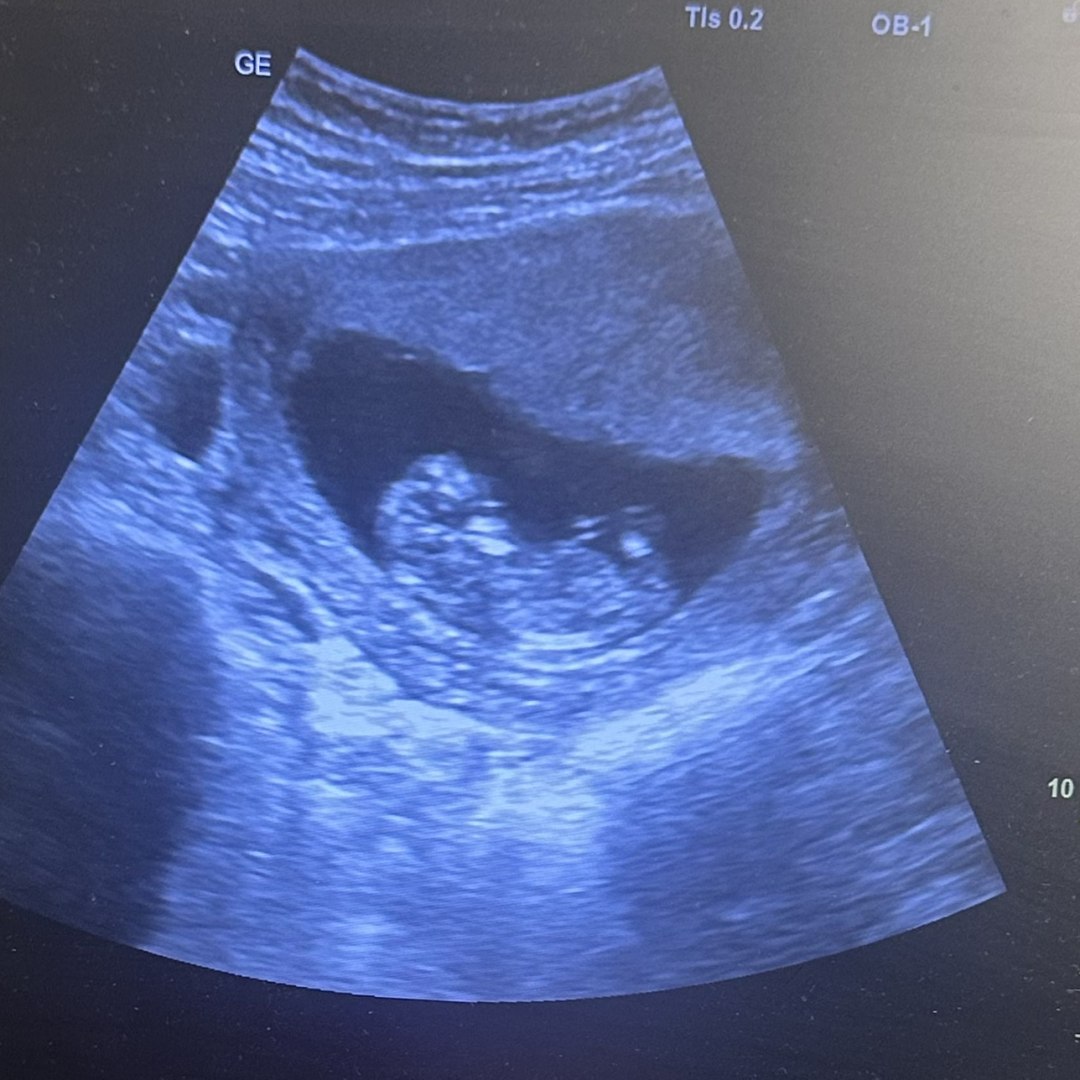 Photo shared by Jordan for their Babylist baby registry.