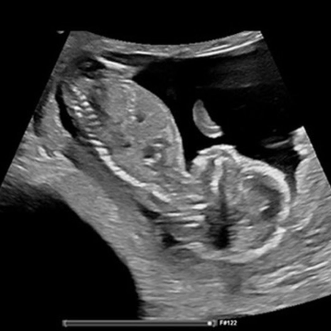 Photo shared by Jaleah for their Babylist baby registry.