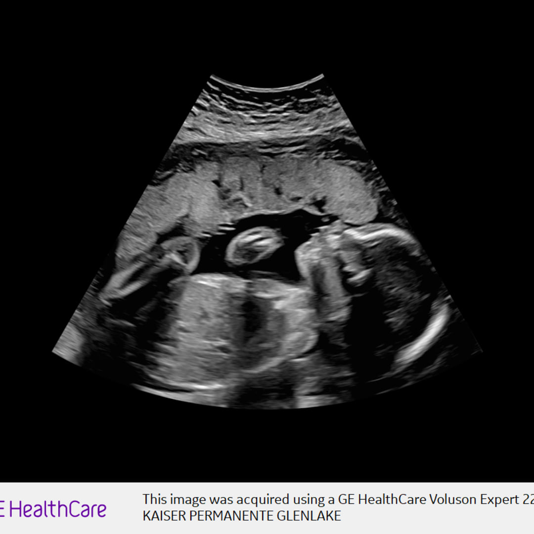 Photo shared by Jennifer for their Babylist baby registry.